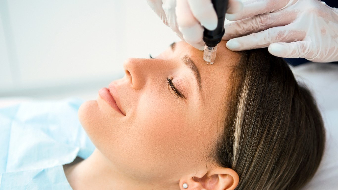 What is Skin Needling and What Can It Treat?