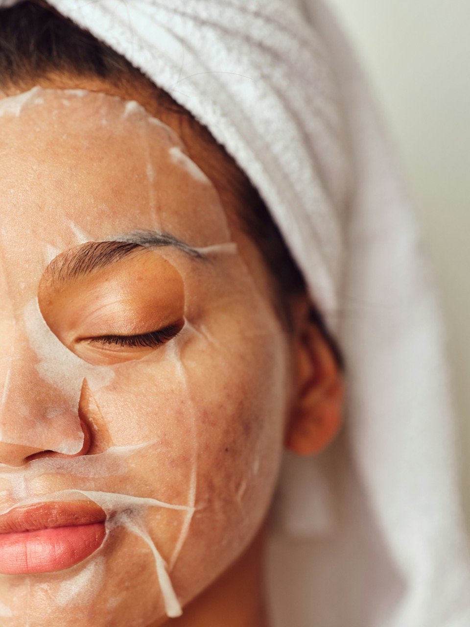 Corrective Skin Peels treatment at NV's Skin and Body Clinic