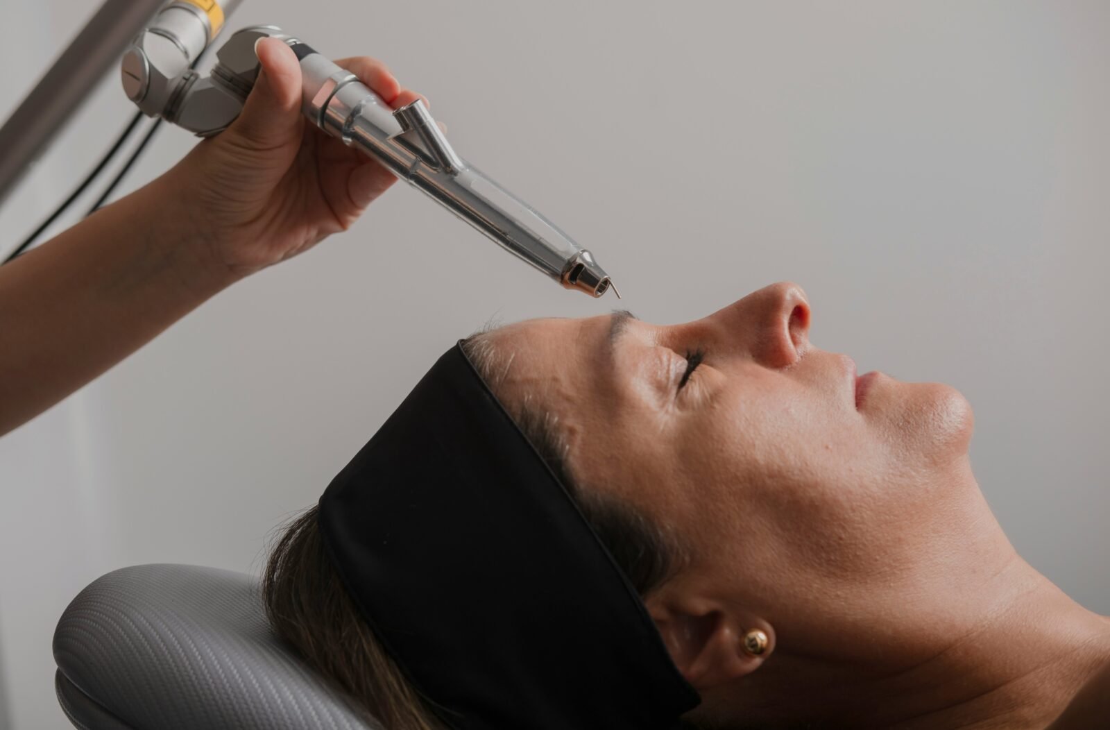 Fibroblast Plasma treatment at NV's Skin and Body Clinic